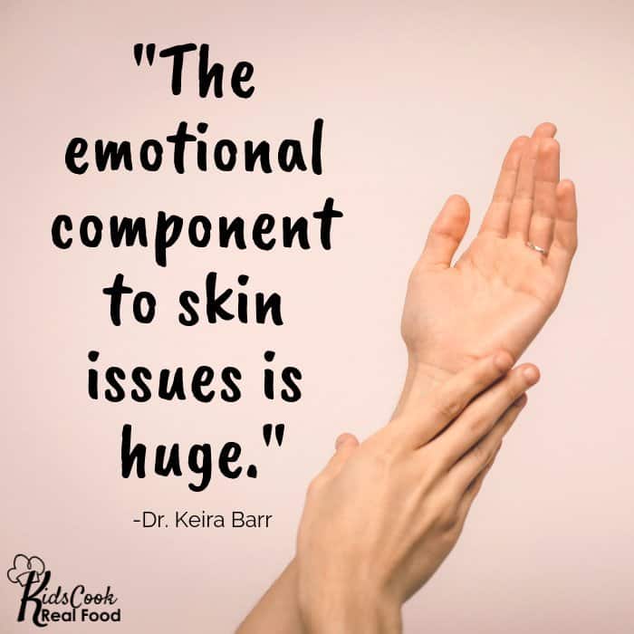 The emotional component to skin issues is huge. -Dr. Keira Barr